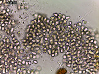 <p>Die bei uns am häufigsten vorkommende pilzliche Blattfleckenkrankheit der Rosskastanie ist die Guignardia-Blattbräune. Bereits ab Mai treten die…</p>