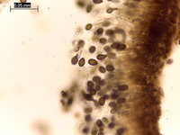 <p>Seit einigen Jahren häufen sich Befallsmeldungen von Juglanconis juglandina auf Walnussbäumen. Obwohl der Pilz historisch eher als Schwächeparasit…</p>